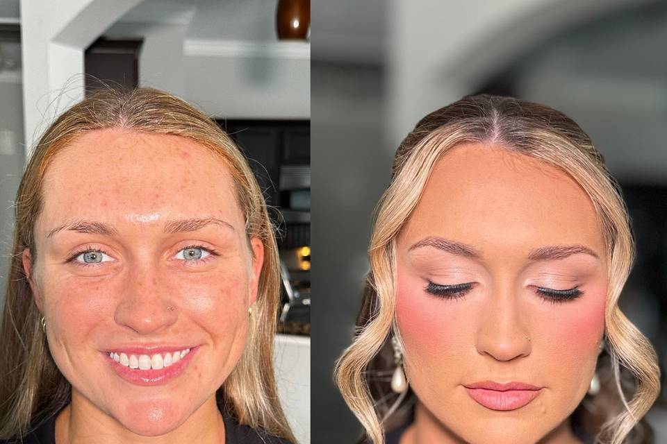 Before and after