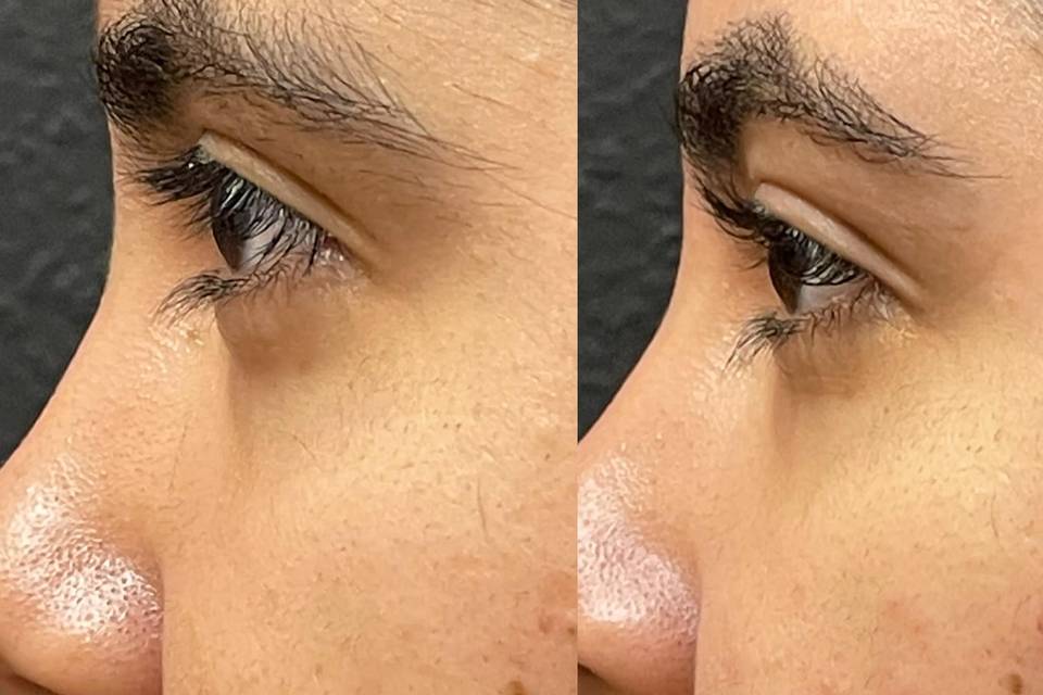 LASH LIFT