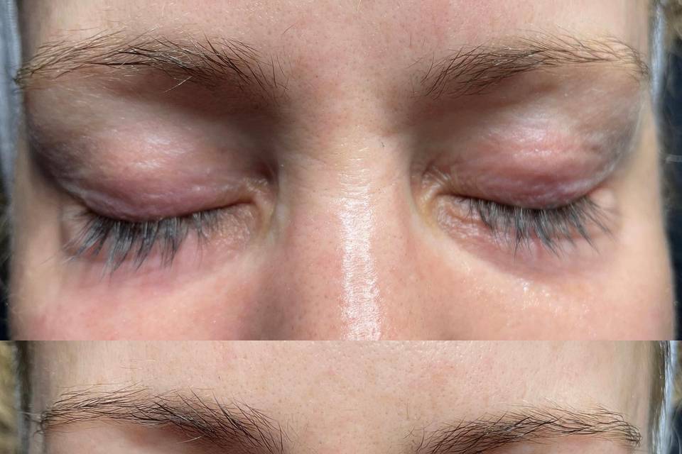 Nanofusion with Lash Lift