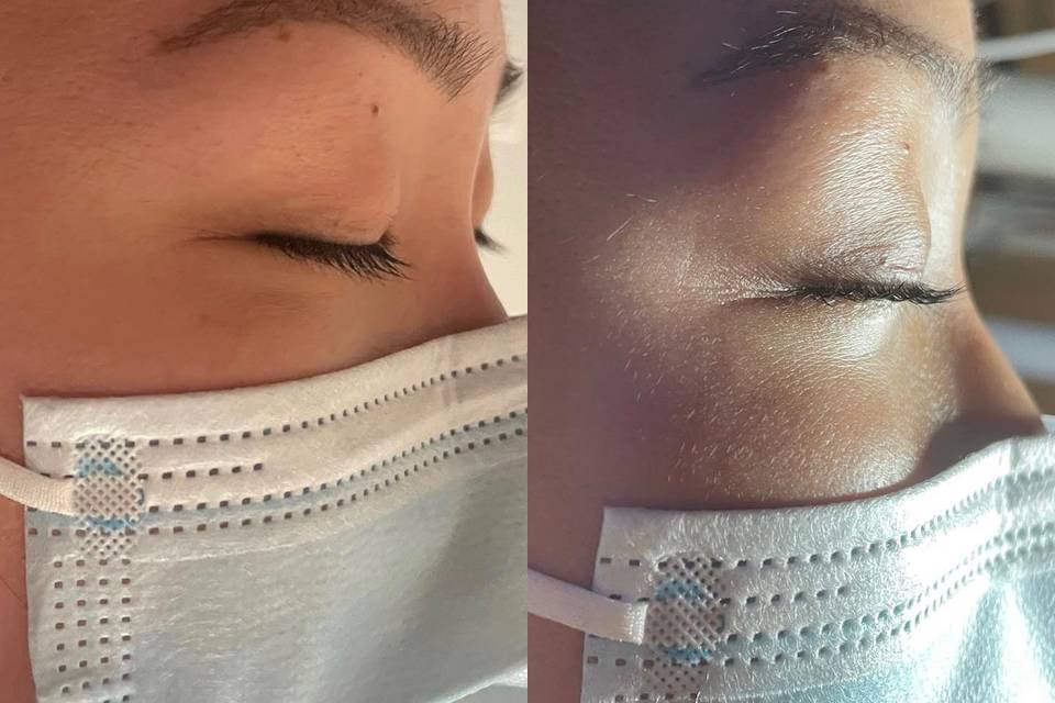 Lash lift