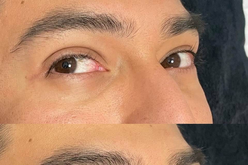 Lash Lift