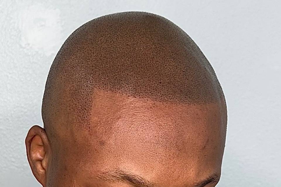 Defined Hairline