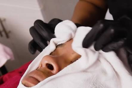 Hot towel facial