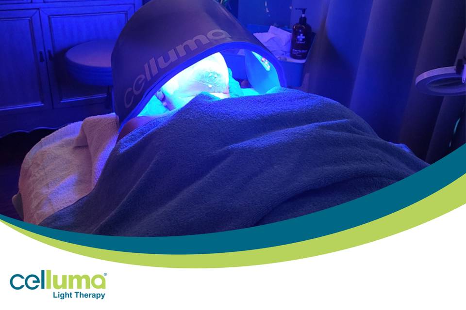Celluma LED for Skin Clearing