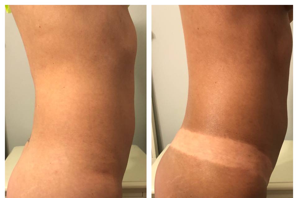 Happy Client Before & After