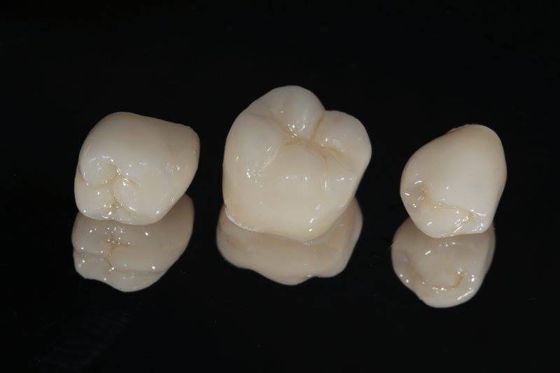 Crown implants