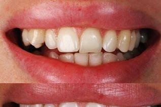 Manhattan Dental PLLC