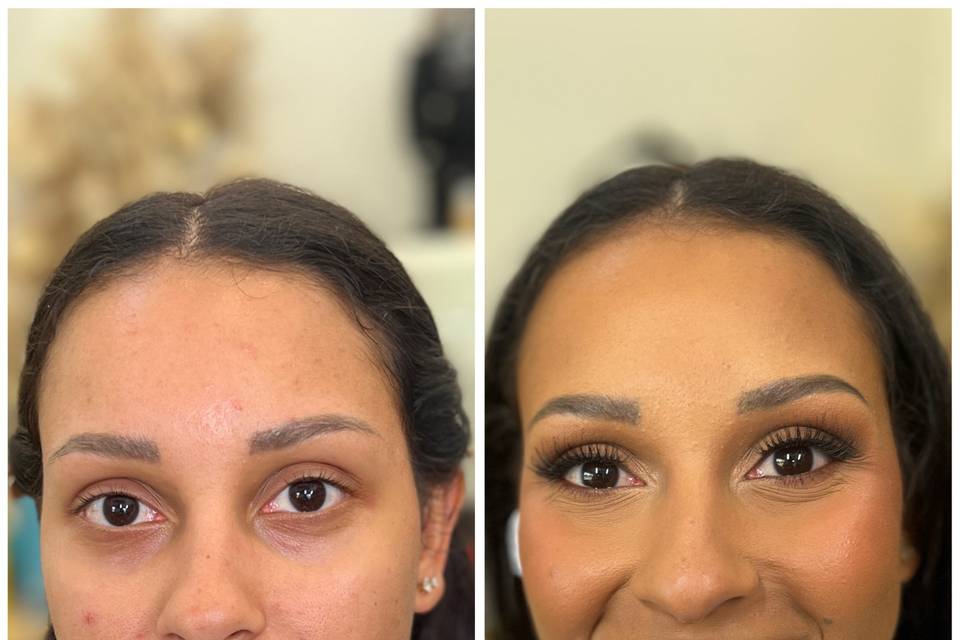 Before and after