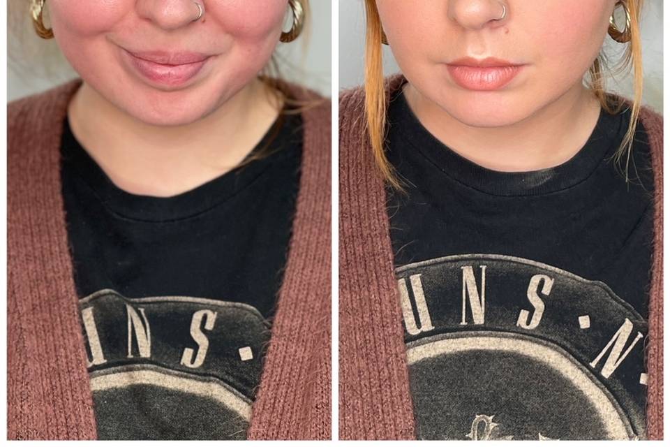 Stunning before and after