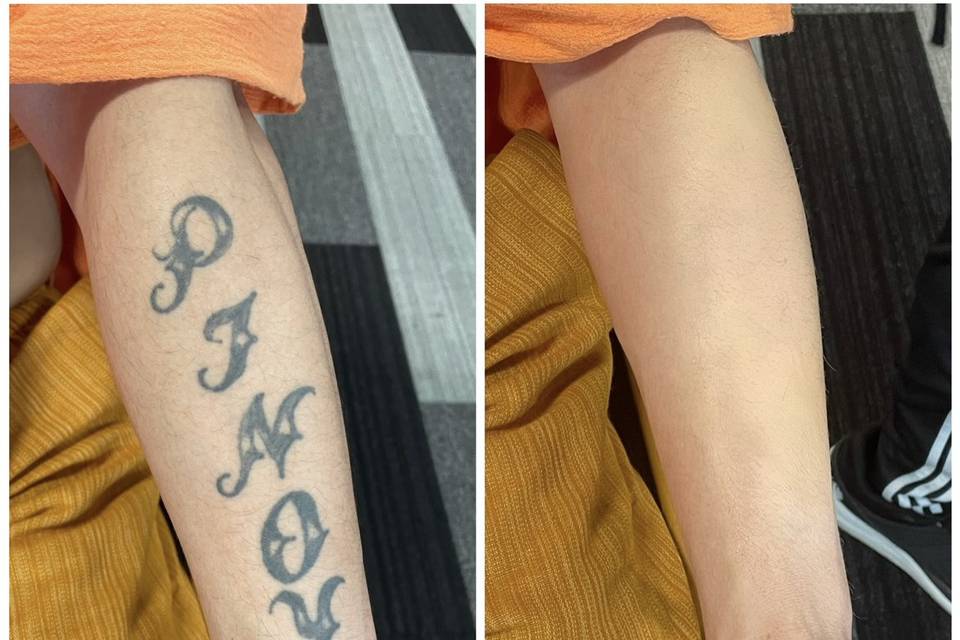 Tattoo Cover up