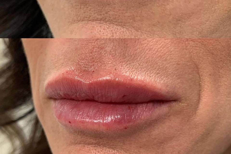Plumper, more visible lips