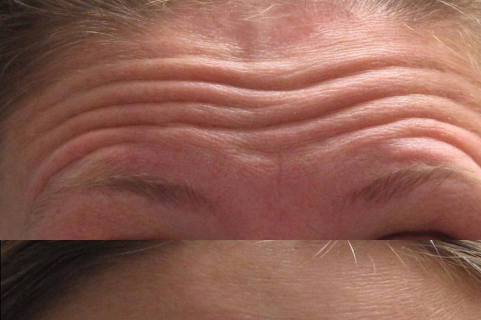 Help prevent future wrinkles
