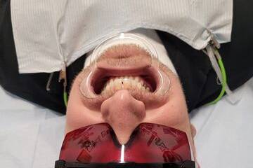 Ready for treatment
