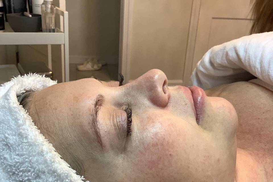 Before Dermaplane Facial