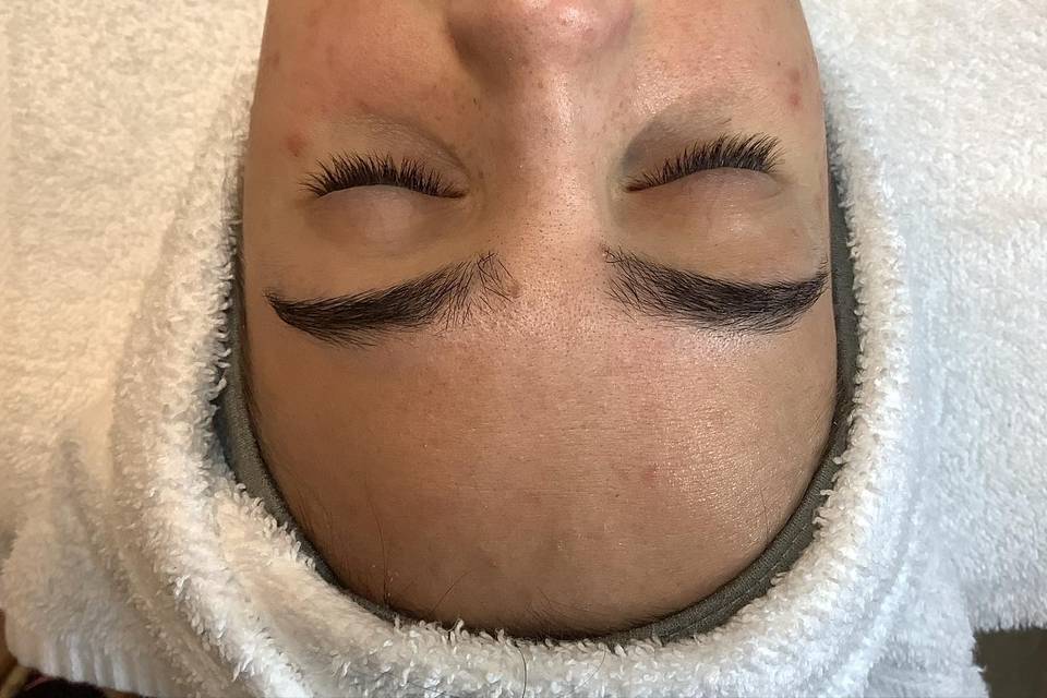 Before Clearing Peel