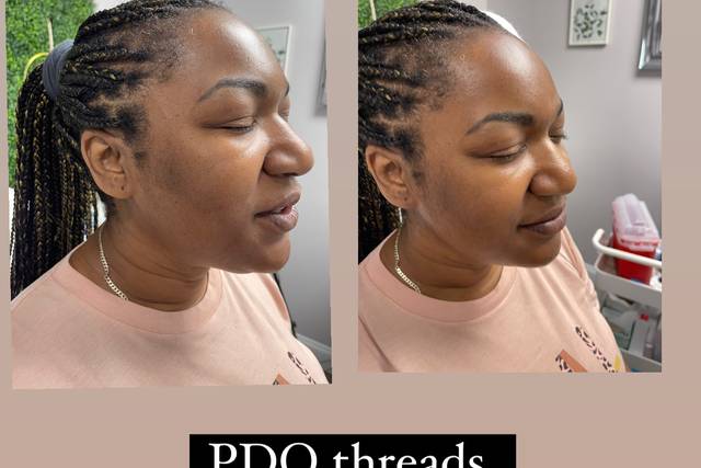 PDO THREADS