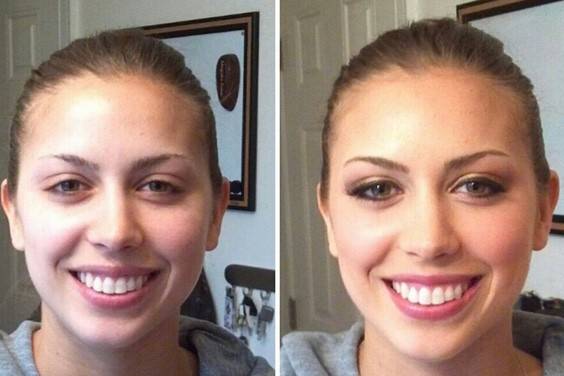 Before and after