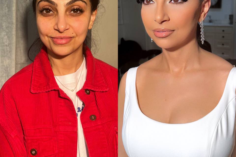 Before and After