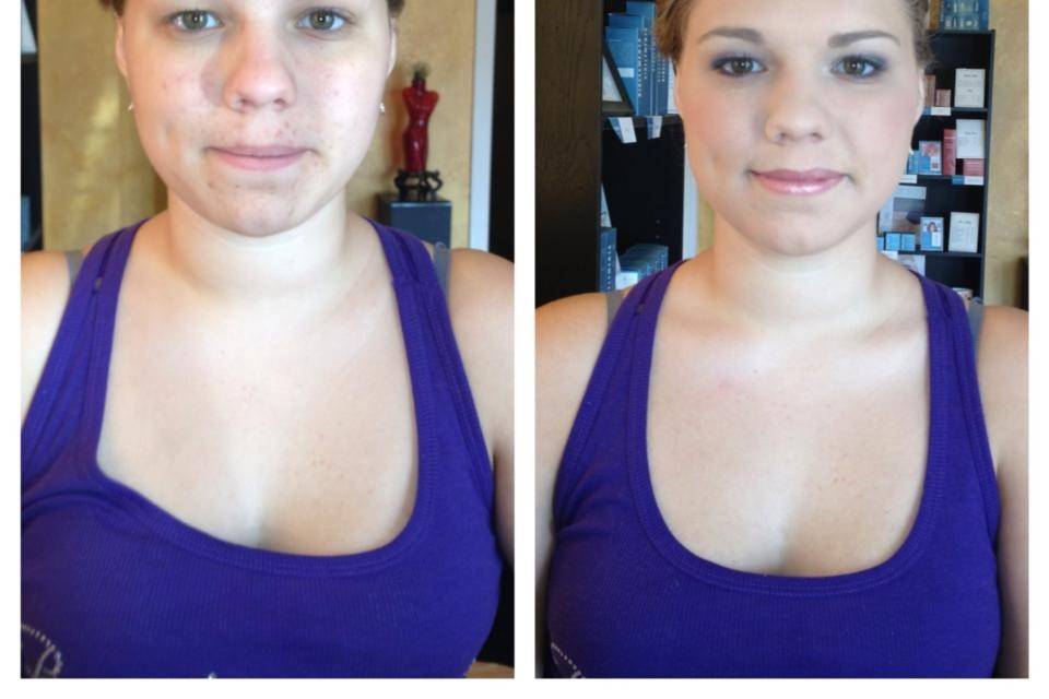Natural Glo Skin Care