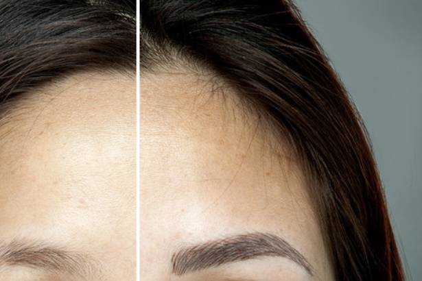 Microbladed eyebrows