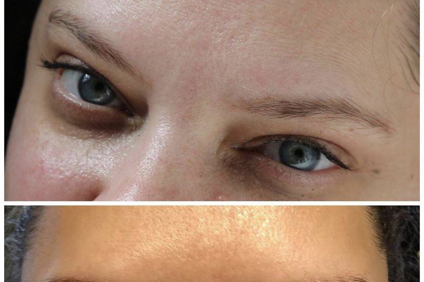 Before and after microblading