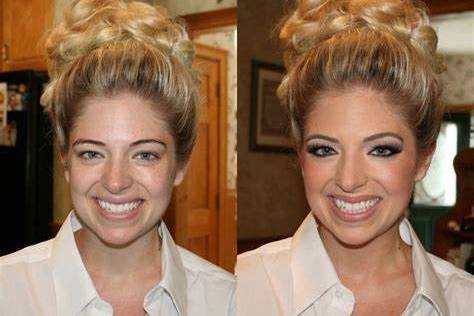 Before and After