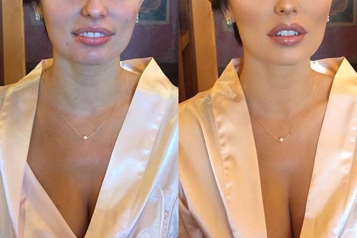Glamorous Before and After