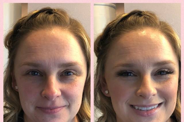 Before and after