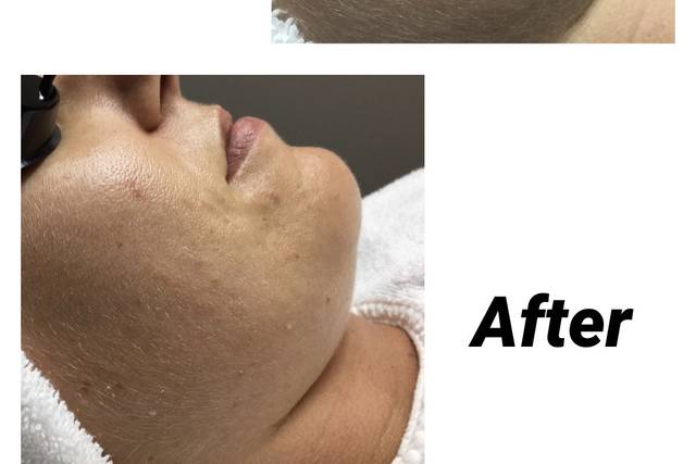 Before and after