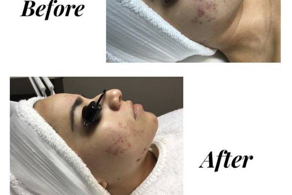 60 days before and after