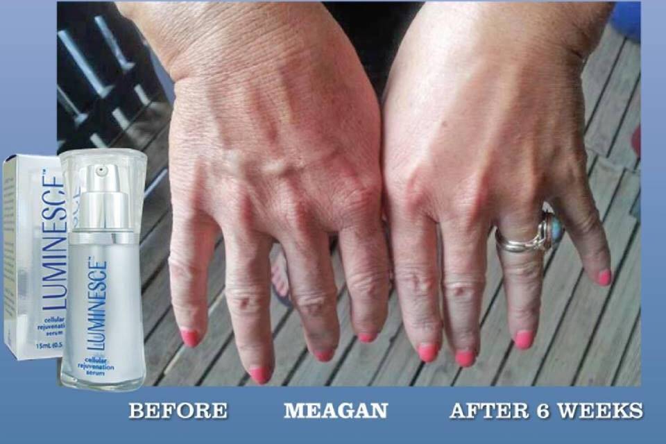 Luminesce Serum - Make those hands younger for those ring pictures!!