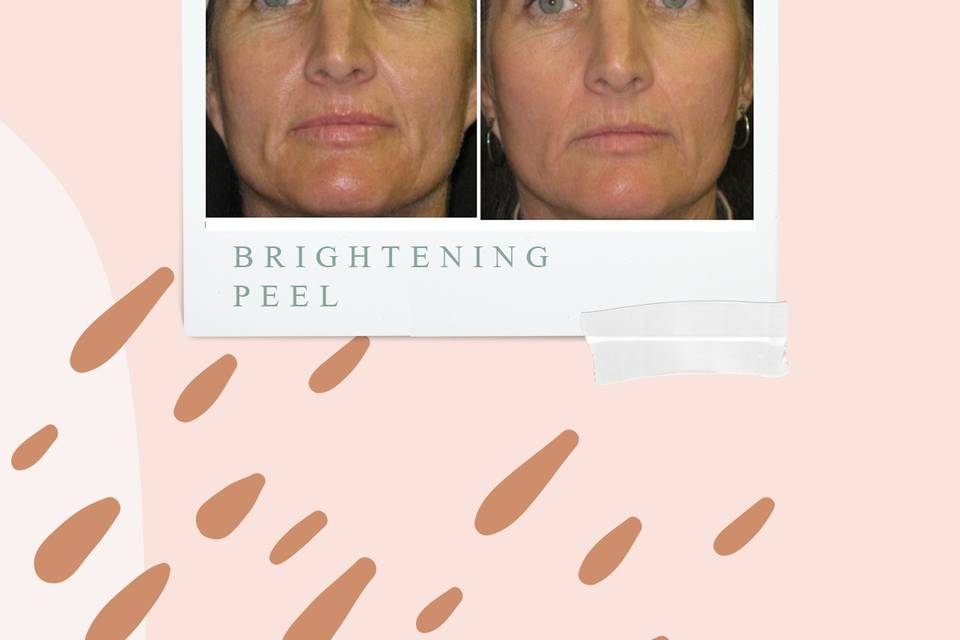 Luminous peel