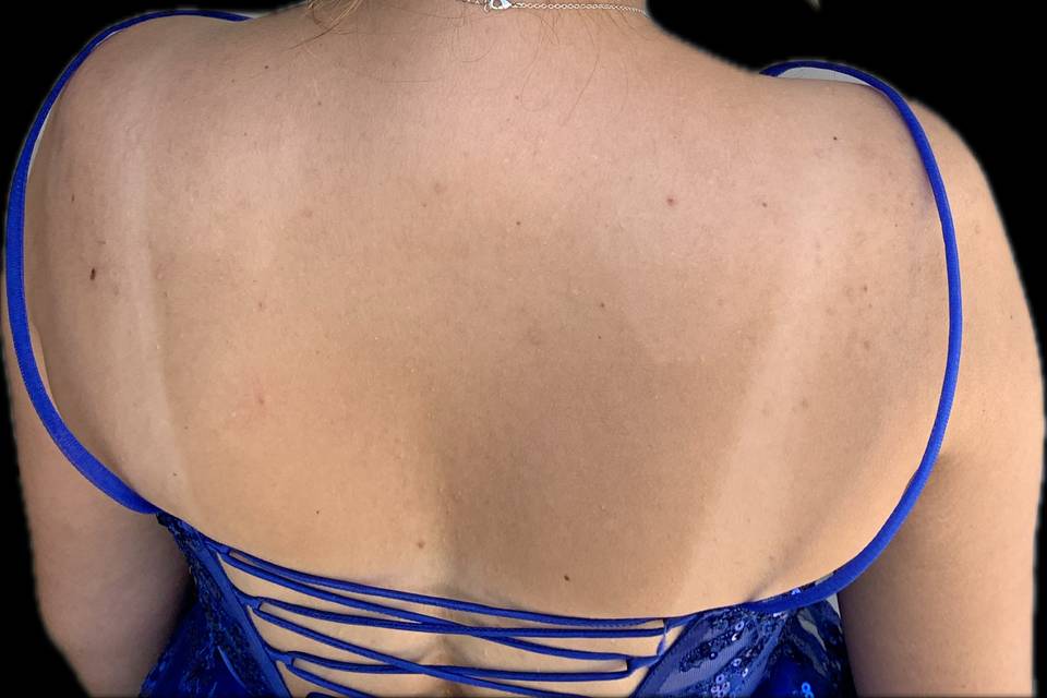 Hair