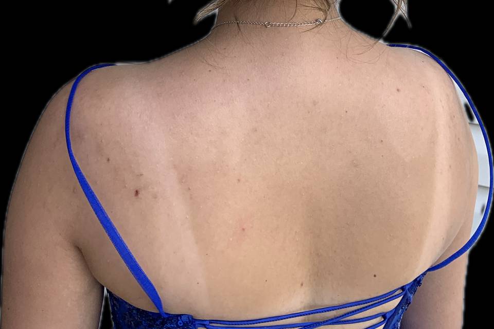Hair