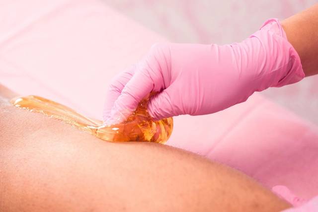 Arm Sugaring