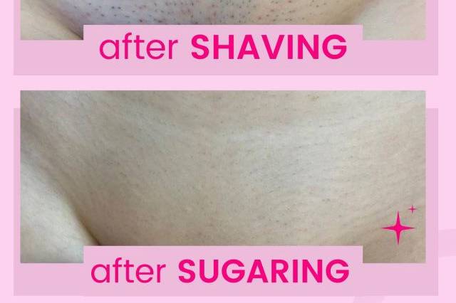 After Shaving vs. Sugaring