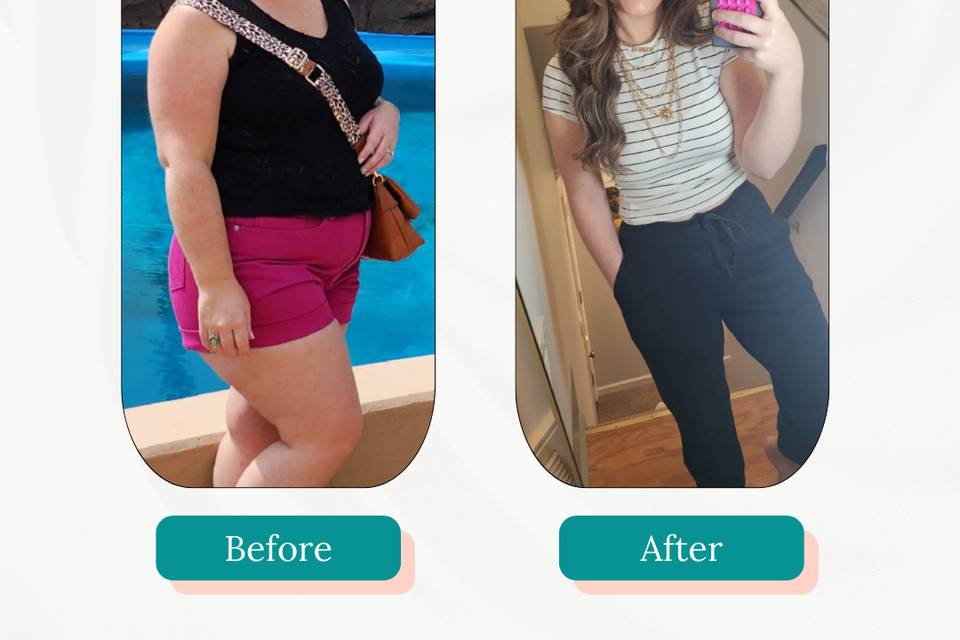 Before & After