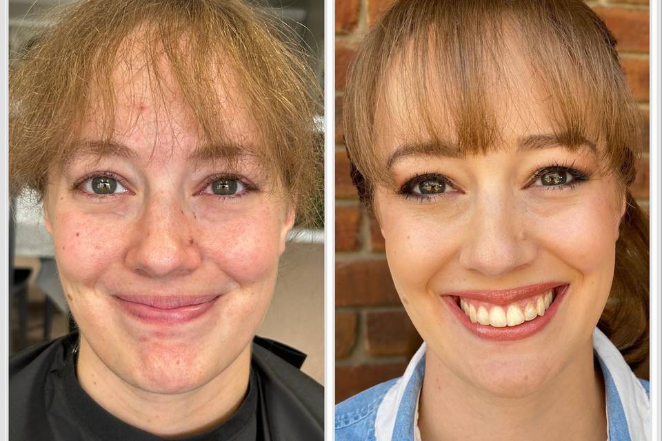 Before and After Natural Look