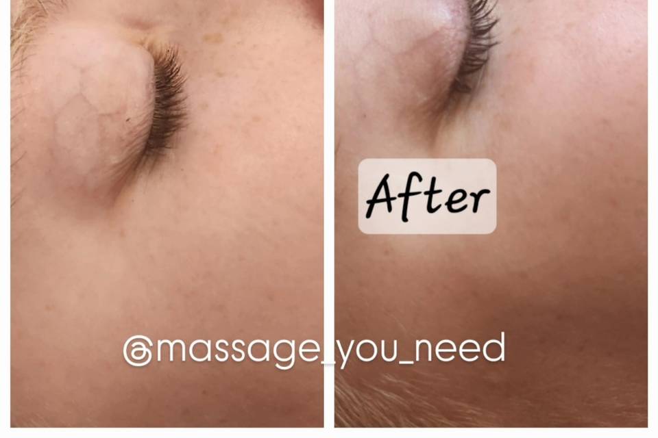 Anime Lash Lift Results