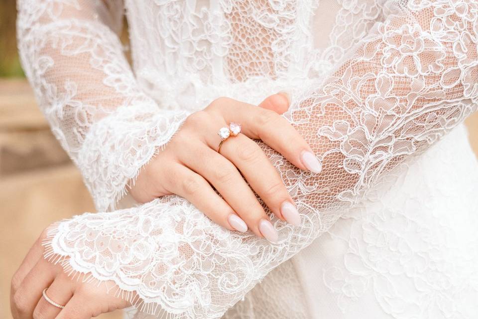 Lace Sleeves