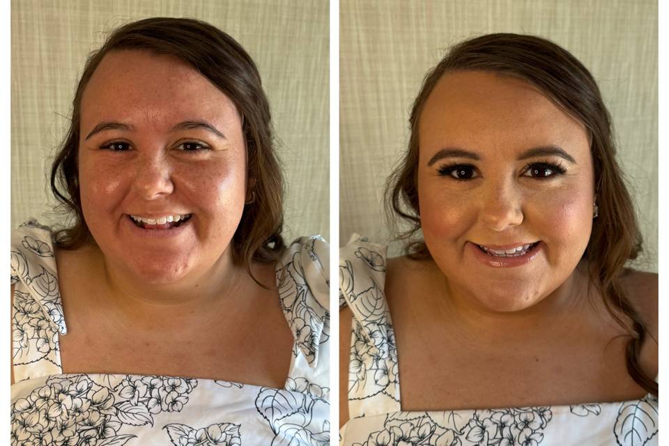 Before and After