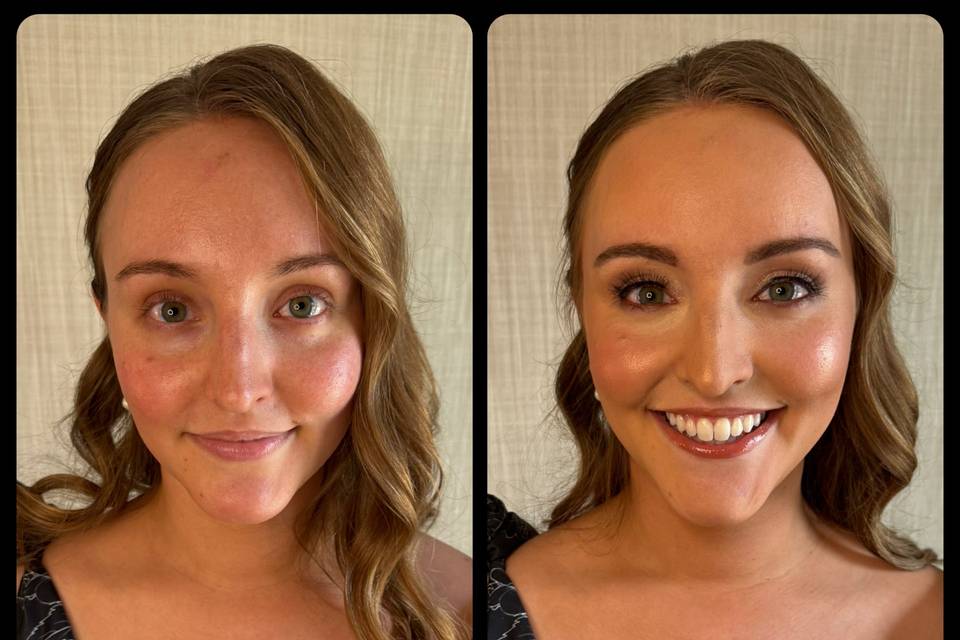 Before and After