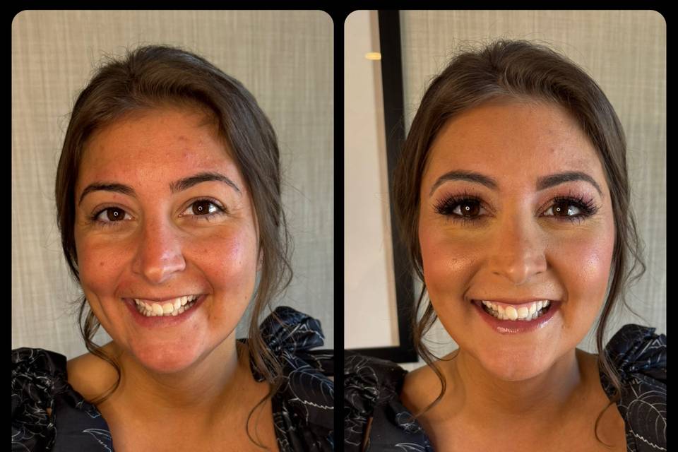 Before and After