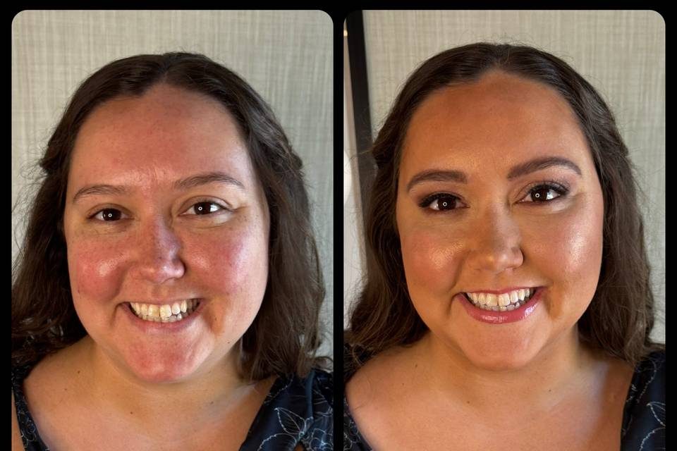 Before and After