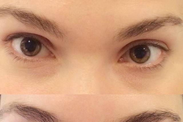Before and after result