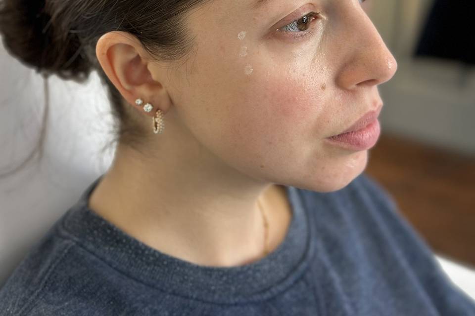 Botox prep