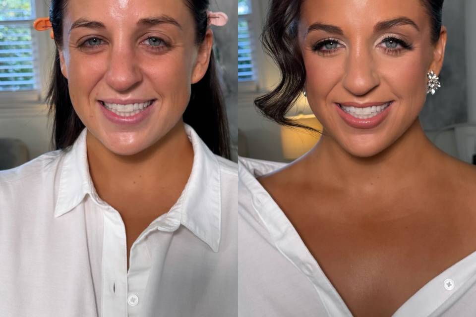 Before/After