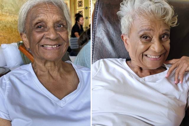 Before and after mature skin