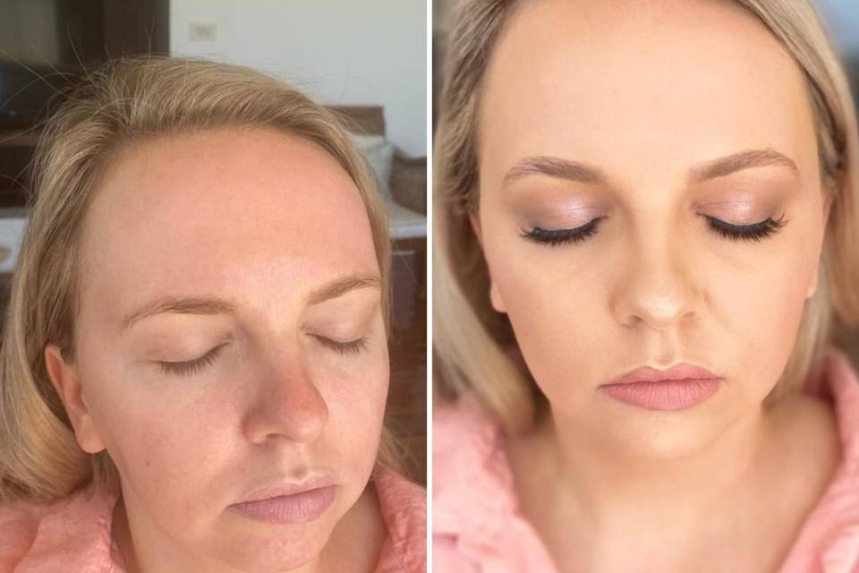 Before and after no filter