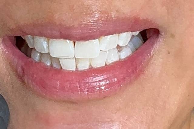 Results